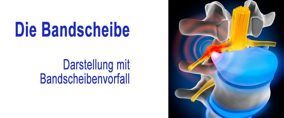 Fitnessstudio Dresden Perfect Body - Die Bandscheibe